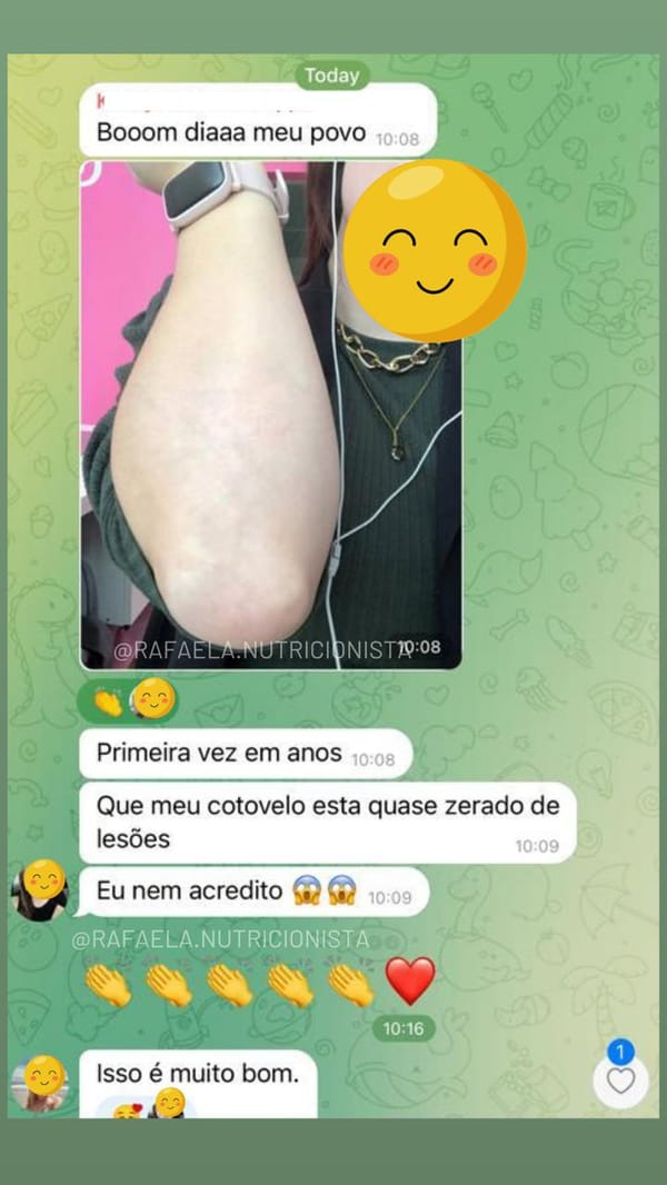 Antes e depois da psoríase 8